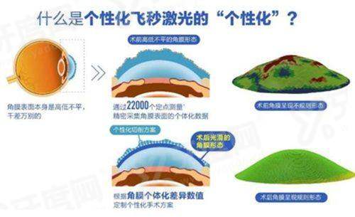 二、兴化爱尔眼科医院怎么样？（正规专精，医疗服务有保护）yanke.yadoo.cn