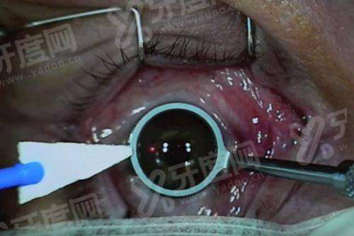 三、佳木斯爱视眼科医院价格表?(价格透明合理,多种项目满足需求)yanke.yadoo.cn