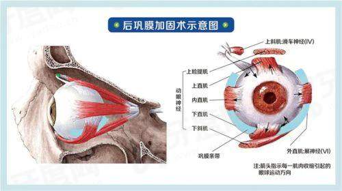 三、郑州美视美康眼科医院价格表？（2024热门项目费用参考）yanke.yadoo.cn