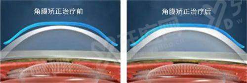 四、南昌市洪都中医院眼科预约挂号方式yanke.yadoo.cn