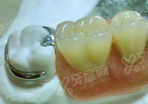 二、清远中泰口腔收费价目表yanke.yadoo.cn