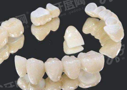 二、德国设备种牙矫正价格透明无隐形消费yanke.yadoo.cn