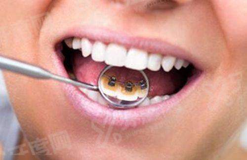 三、简阳牙米口腔医院地址在哪里？（位于市中 心，交通便利）yanke.yadoo.cn