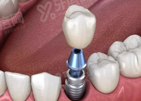 二、邵阳雅贝康口腔医院怎么样?(资质正规,技术实力强,服务优质)yanke.yadoo.cn