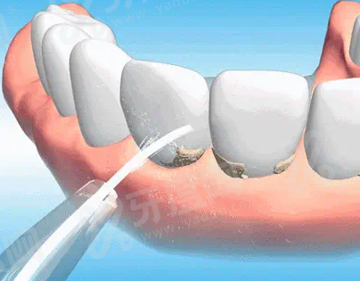 二、汉中小白象口腔医院怎么样？（正规资质+技术特色获认可）yanke.yadoo.cn