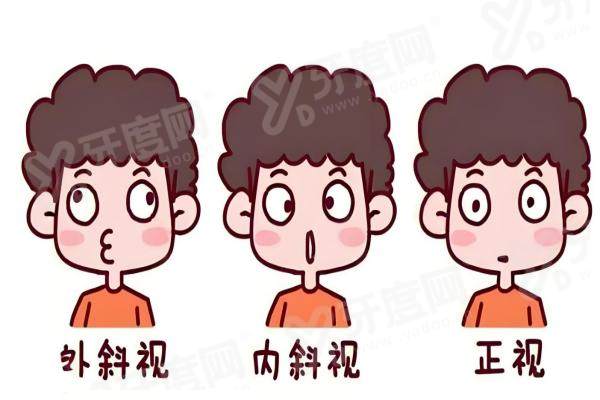 杨隆艳做斜视手术大概多少钱？约 8000 元起，技术娴熟恢复快，助你重获明亮双眸！