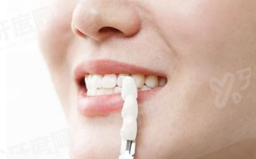 三、常熟安澜口腔怎么预约挂号yanke.yadoo.cn