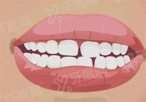 二、曲靖诺贝尔口腔和德韩口腔怎么选？yanke.yadoo.cn