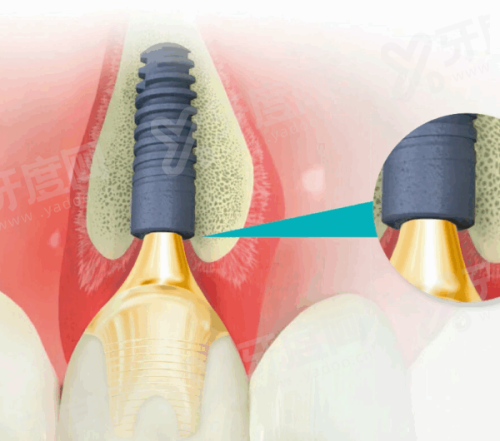 三、温州鹿城牙可美口腔医院地址电话?(地理位置优越,联系方便)yanke.yadoo.cn