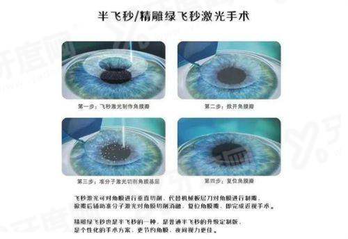 2026年征兵视力标准改变了吗？有调整！2026年征兵视力达到4.5部分能过！