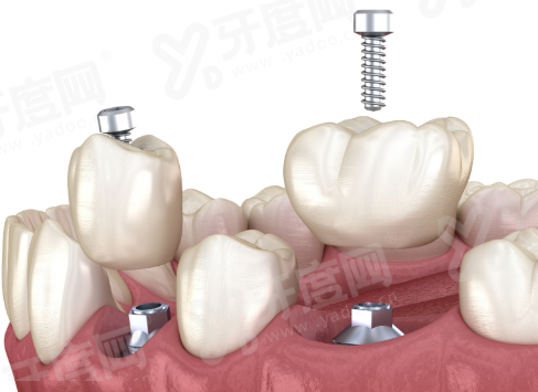 泰州奥米口腔怎么样？正规靠谱牙科，含价格表+地址电话获取指南