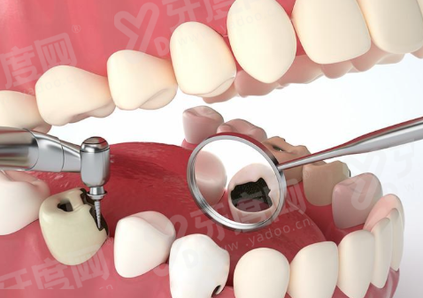 二、辽阳诺贝尔口腔医院价格表?(公开透明,多种项目满足需求)yanke.yadoo.cn