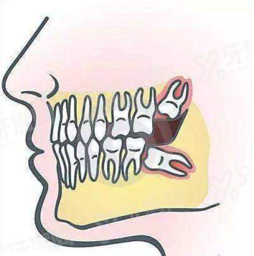 三、沈阳京科口腔医院收费价格参考yanke.yadoo.cn