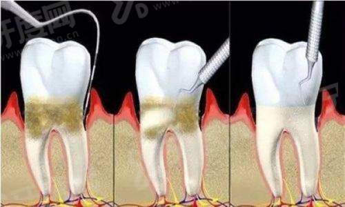 三、哈尔滨医 科 大学附属第一医院口腔科价格表yanke.yadoo.cn