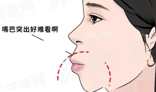 邢台内丘咪呀口腔医院预约挂号攻略：3种挂号方式，附价格表+地址电话