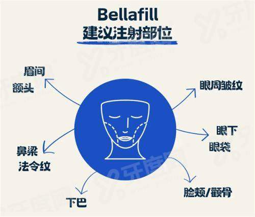 二、郭家妍双眼皮实例yanke.yadoo.cn