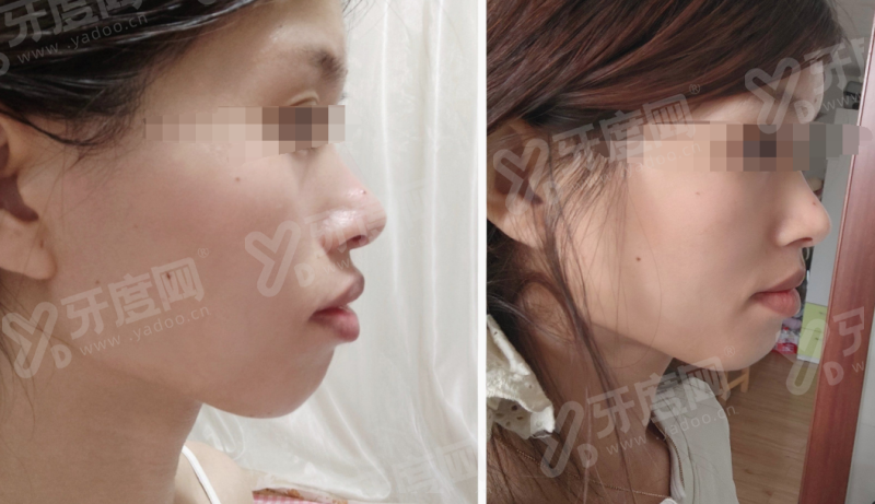 河北省各个医院口腔正畸科哪个医生好？石家庄中诺赵韵、唐山牙博士刘建民、保定合众李艳辉值得选！ 