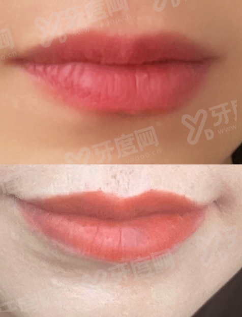 国内能做三件套假体植入的正规医院有哪些？北京美莱、上海艺星、广州曙光这三家医院上榜前三！