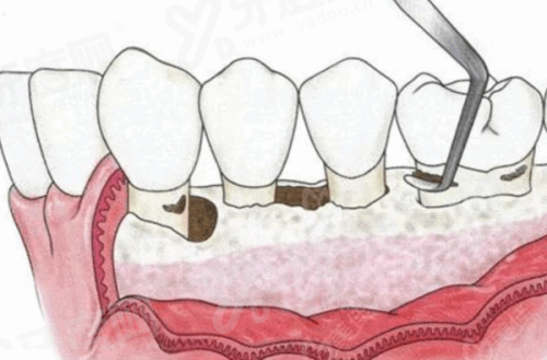 三、杭州萧山牙科医院预约挂号yanke.yadoo.cn