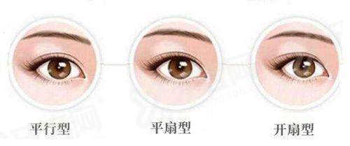 温建民拇外翻真的好吗？真的好，个性化截骨方案和快速修复真的牛！