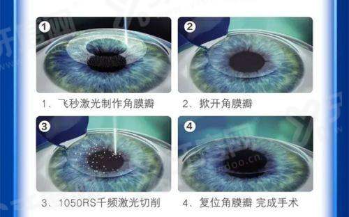 三、想去武汉普瑞眼科做手术，具体怎么预约挂号？yanke.yadoo.cn