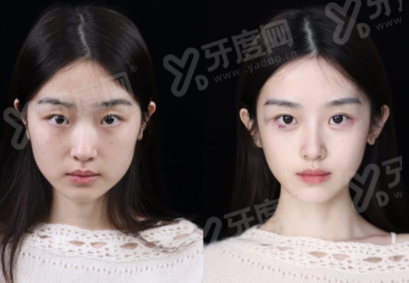 韩立志医生做眼睛怎么样？技术优势与成效保护yanke.yadoo.cn