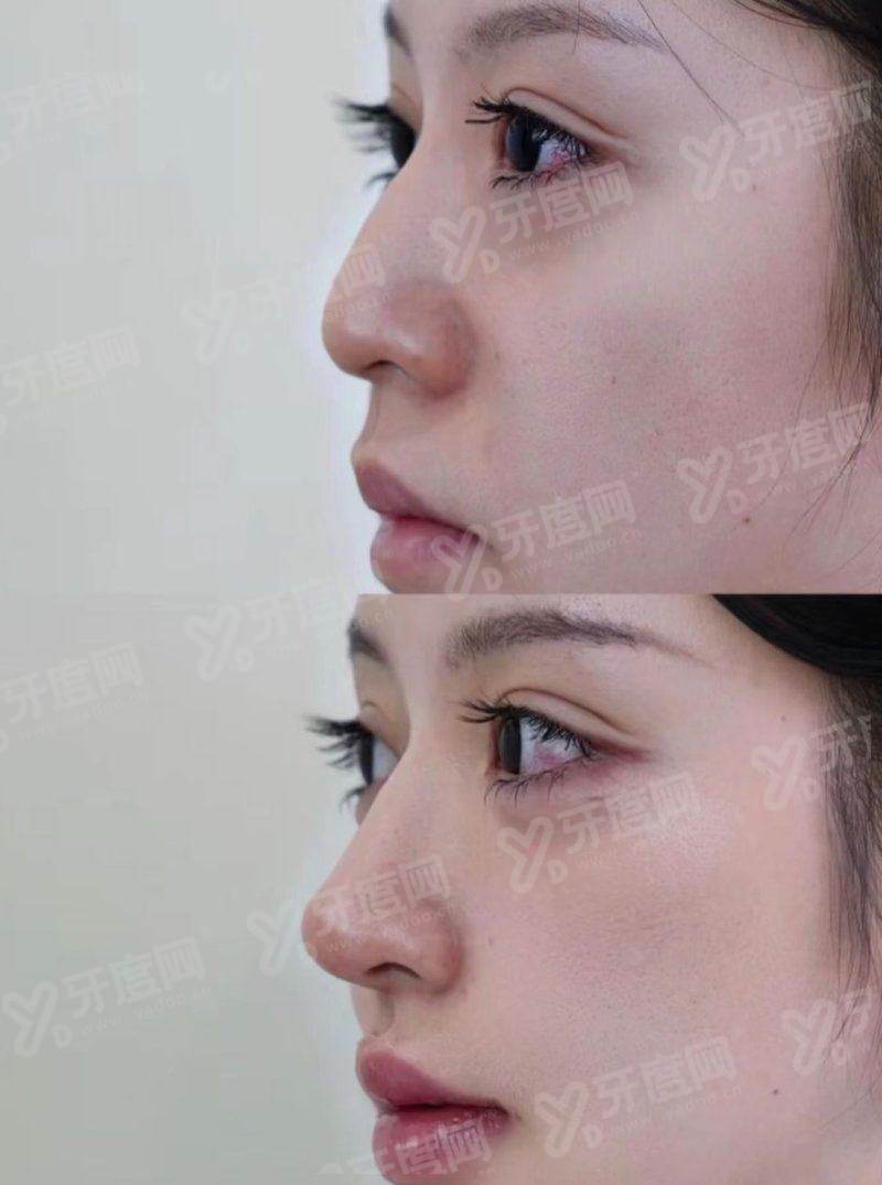 上海韩立志在哪家医院？在上海韩氏医疗美容门诊部，做眼睛手术评价好!