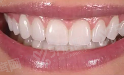 北京积水潭医院口腔科上班时间：8:00-17:30无休！价格表+地址电话公布！