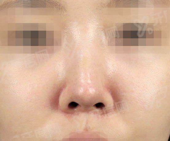 沈阳医大一院整形美容科价格表：眼部2k/鼻部整形5k元起