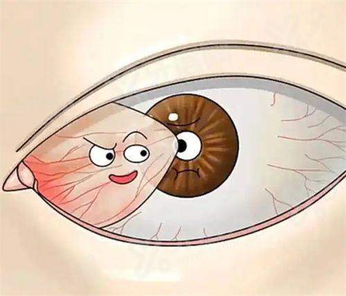 四、承德附属眼科医院预约挂号方式yanke.yadoo.cn