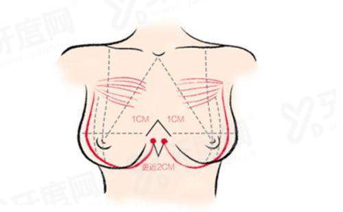 湖南益阳格莱美医疗美容医院口碑评价怎么样？医生面诊耐心方案自然，正规机构收费透明安全