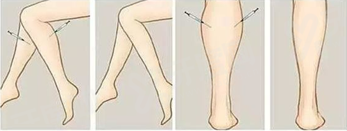 王乙立做痕筋膜提提升好吗？技术专业效果自然，不少人反馈恢复快又好看！