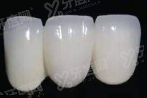 二、镇江京口励程口腔医院怎么样?(正规靠谱,技术设备精良,服务贴心)yanke.yadoo.cn