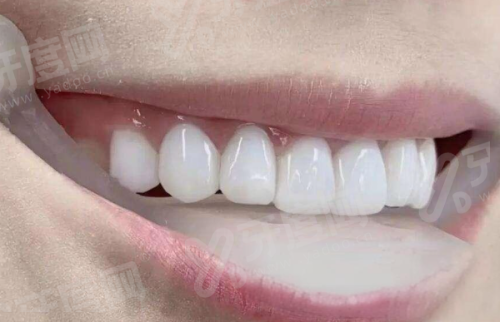 濮阳第三人民医院牙科哪个医生好点？于飞/李永彦/刘志勇/样俊周等医生技术好