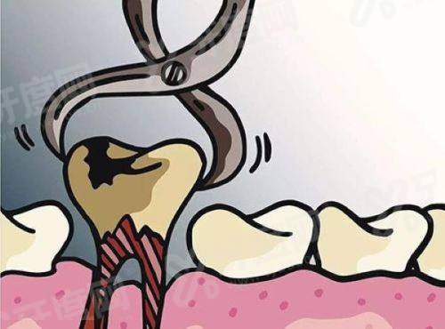 二、昆山鲸华口腔医院怎么样？（正规资质+技术亮点，患者口碑良好）yanke.yadoo.cn