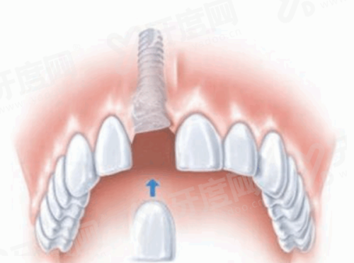 襄阳时代口腔医院预约挂号：线上线下快速约！附地址电话+上班时间