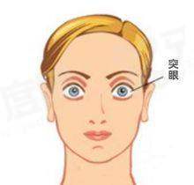 二、昭通艾维眼科医院地址在哪里？在昭阳区昭阳大道 405 号yanke.yadoo.cn