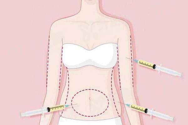 武汉亚韩整形美容医院抽脂怎么样？三级资质收费透明，5G 光雕紧肤塑形自然流畅