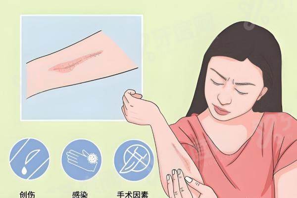 武汉华美整形医院祛疤痕效果好吗？收费透明中等，分型分期联合治疗让疤痕变淡