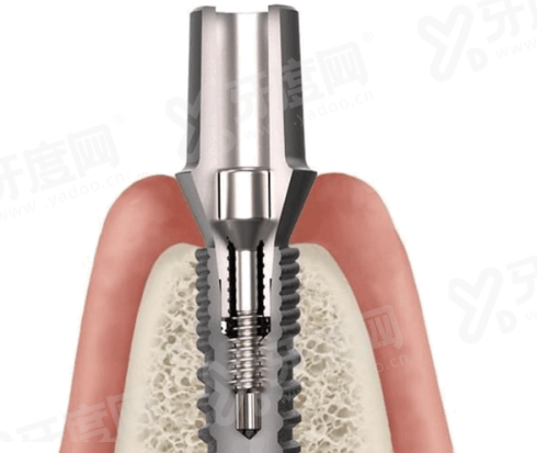 三、宿迁金铂利口腔收费价格表yanke.yadoo.cn