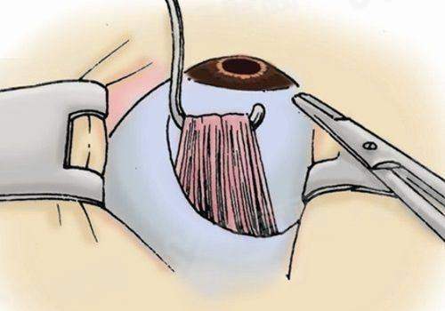 二、郑州视献眼科的医生团队技术实力强吗?yanke.yadoo.cn