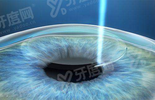 三、想找郑州视献眼科医院医生做手术怎么约?yanke.yadoo.cn