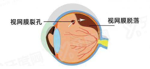 二、保定市第一中 心医院眼科有哪些医生坐诊？擅长什么项目？yanke.yadoo.cn