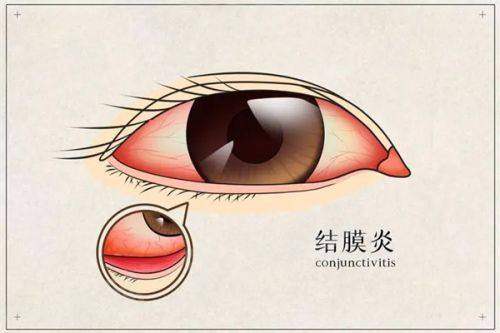 三、南昌华厦眼科医院怎么预约及费用地址详解？yanke.yadoo.cn