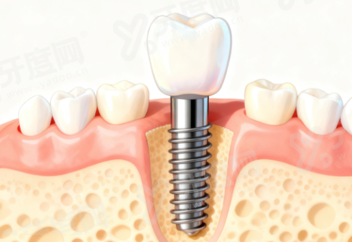 三、睢宁牙百佳口腔医院地址在哪里?在睢城街道红叶北路一号yanke.yadoo.cn
