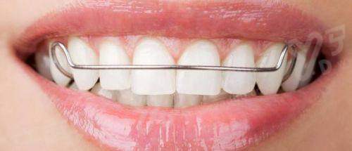 二、介绍诺贝尔亲水植体价格yanke.yadoo.cn