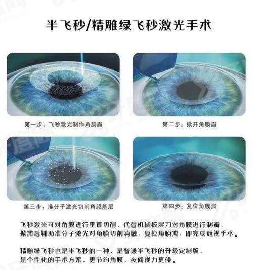 安医眼科廖荣丰门诊时间：周一至周日全接诊，节假日无休更贴心