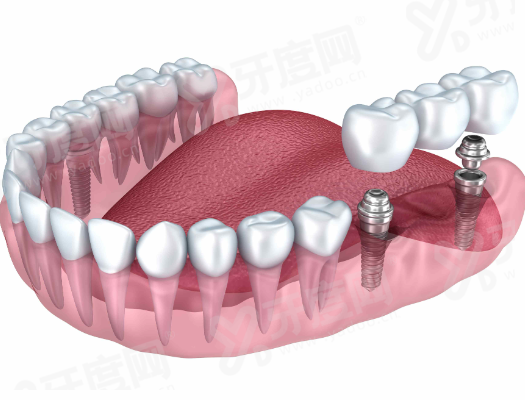 二、介绍深圳格伦菲尔口腔医院是正规医院吗？yanke.yadoo.cn