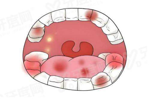 三、威海艾瑞口腔医院价格表？（价格透明合理，性价比高）yanke.yadoo.cn