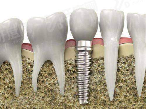 三、金坛第三人民医院口腔科价格表yanke.yadoo.cn